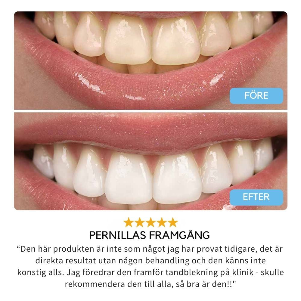 AllWhite - Tooth Polish